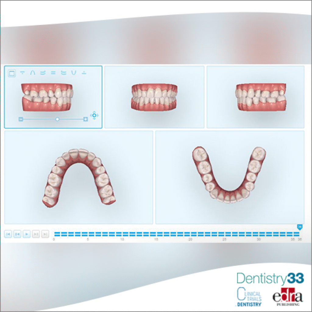 Digital Mock-Ups in Aesthetic and Cosmetic Prosthodontics: Treatment Planning Excellence 6 6 2