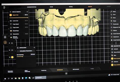 Smile Design Principles in Full Mouth Rehabilitation: Aesthetic and Cosmetic Prosthodontics 6 6 22
