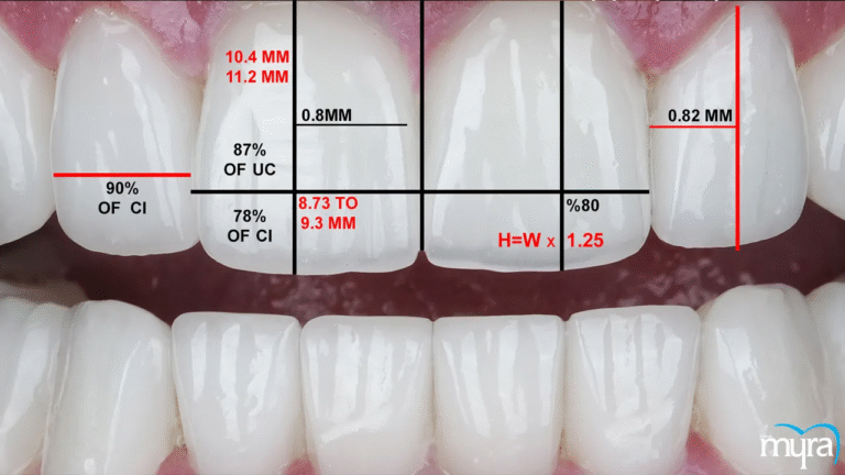 Managing Tooth Proportions for Harmonious Smiles: A Comprehensive Guide to Aesthetic and Cosmetic Prosthodontics