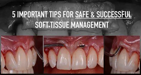 soft tissue management
