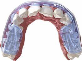 Orofacial Pain and Muscle Spasm: A Comprehensive Guide for Dental Practitioners 4 t1 2