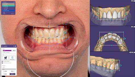 Smile Design Principles in Full Mouth Rehabilitation: Aesthetic and Cosmetic Prosthodontics 15 t4 2