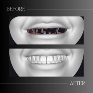 3D lip smile dental design STL file before and after visualization