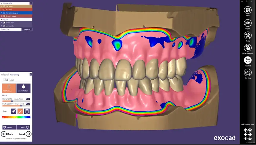Digital complete denture CAD design showing full-arch tooth setup, gingival base contours, and border outlines for 3D printed denture base and bonded teeth workflow.