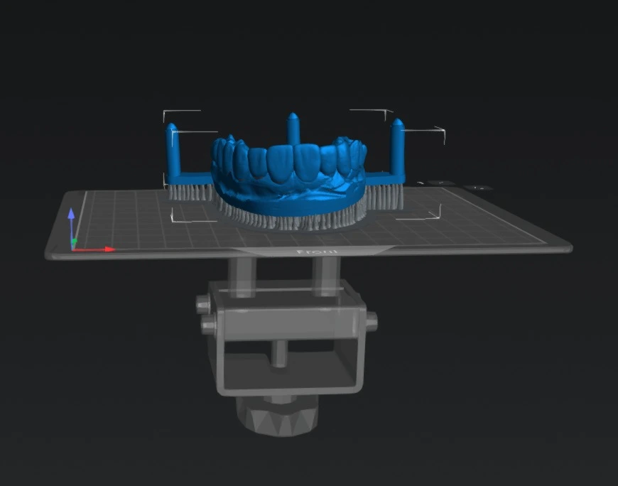 dental3dprinting course 2 Digital nesting of the dental diagnostic wax-up in Chitubox slicer software. Showing proper support generation and orientation for 3D printing the master model used in the resin stamp technique.