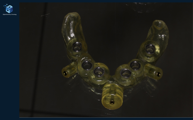 A real translucent mandibular surgical-guide component with metal sleeves, photographed on its original dark background beside a small DDS logo.