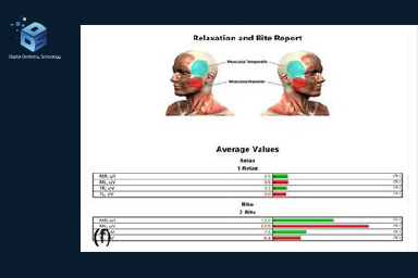 An authentic rest-and-bite EMG average-value report with schematic muscle views and original bar summaries, beside a small DDS logo.