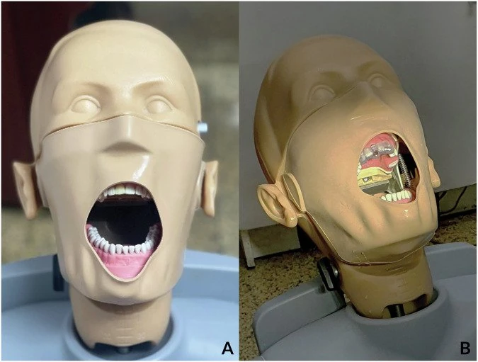 Two photographs of a dental phantom head: an acrylic upper-jaw model and a tooth-supported surgical guide seated on the model.
