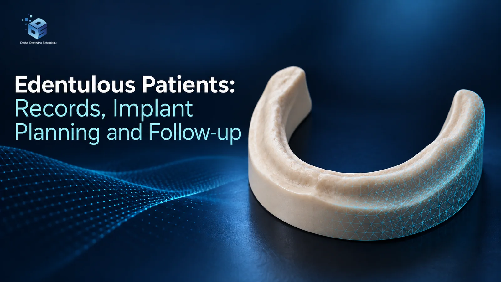 Edentulous patients article 1 AI-generated conceptual toothless mandibular teaching cast with an open horseshoe form and illustrative cyan mesh; headline: Edentulous Patients: Records, Implant Planning and Follow-up.