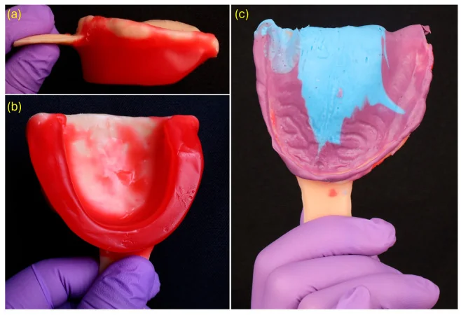 Wax occlusion rim on a printed maxillary tray, followed by a purple-and-blue functional impression.