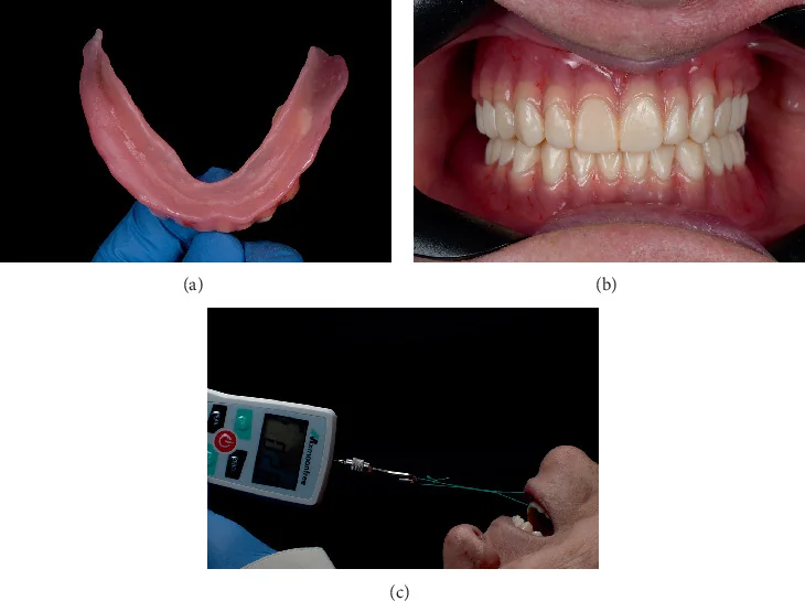 Mandibular denture intaglio, delivered dentures in occlusion, and a force-gauge retention test.