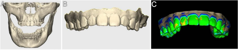 Source Figure 2, panels A–C: CBCT jaw reconstruction, upper-arch surface scan and color-overlaid fitted datasets.